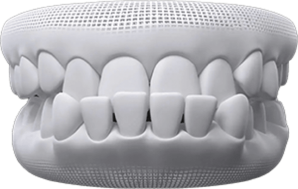 invisalign before after